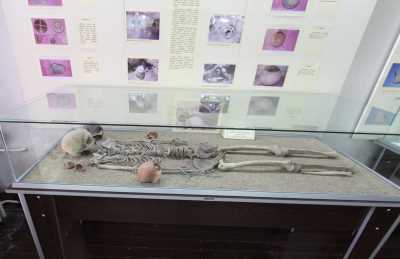 İnsan İskeleti (Yozgat Müzesi)